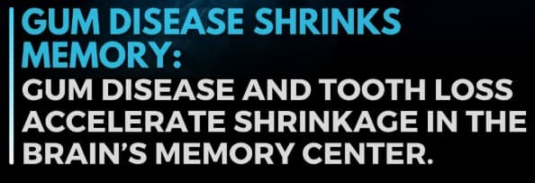 Malattia gengivale e memoria - Studio Buda